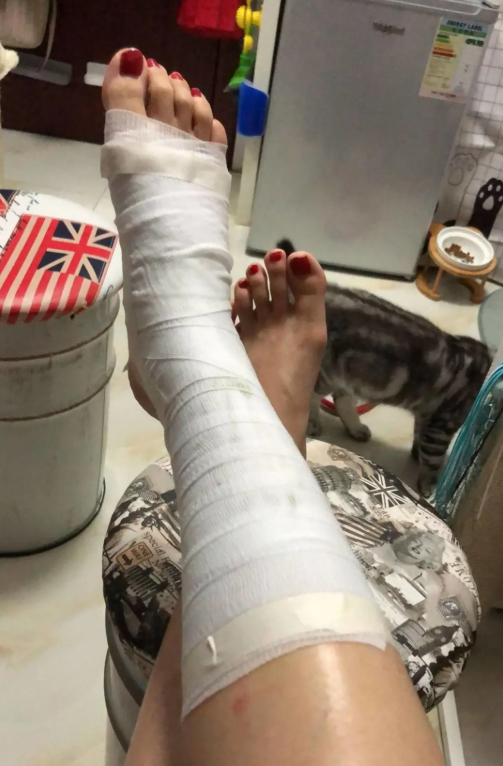 猫赃俱获为了偷吃食物猫咪不惜将铲屎官的脚烫伤