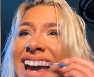 美国|是个狠人！美国美容博主用指甲锉整牙 隔着屏幕都觉得疼