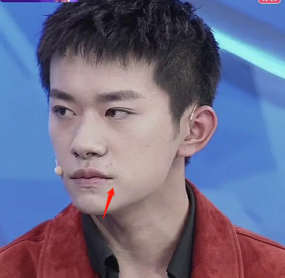 在截图当中的易烊千玺脸上的痘痘可全部的都露出来了马脚.