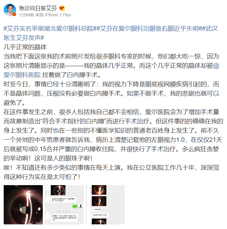 艾芬|武汉抗疫医生艾芬：爱尔医院为增加手术量故意制造“符合手术指征的白内障”
