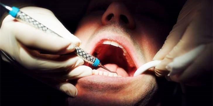 海外牙医网络直播:通过检查口腔,医生们能发现一些小秘密