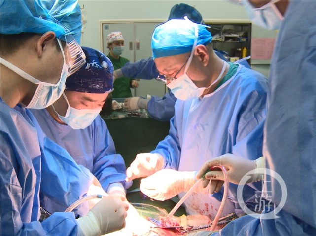 她带着别人的肝脏活了下来2021年年初,王珍珍肝移植手术在大坪医院