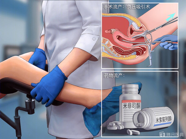 无痛人流就是上午手术下午上班真相没那么简单