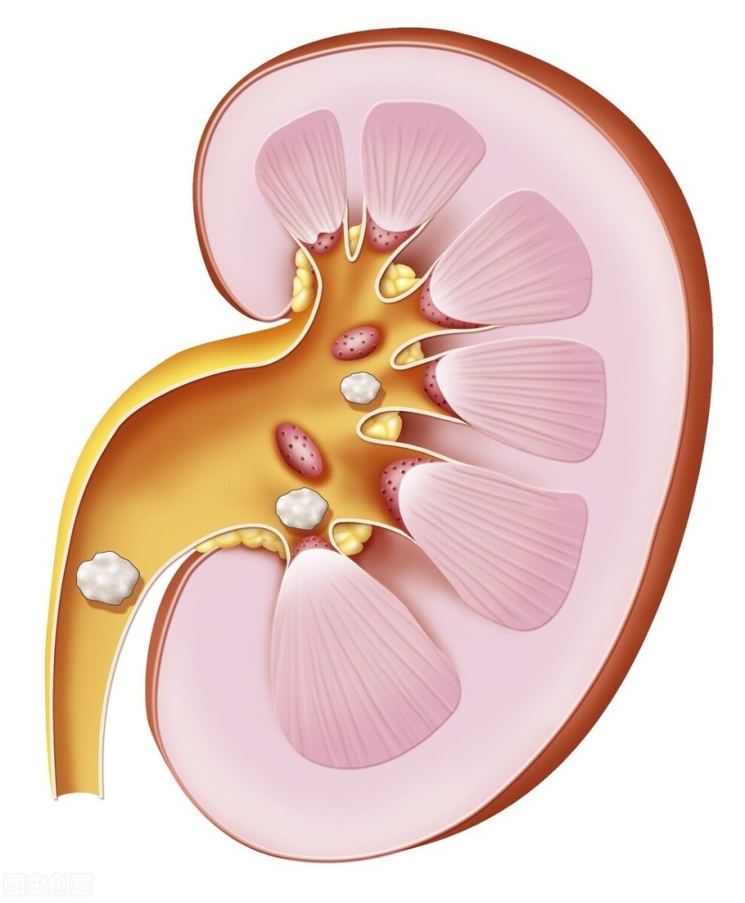 肾病|肾好不好，一杯尿就知道！医生教你如何查看尿常规