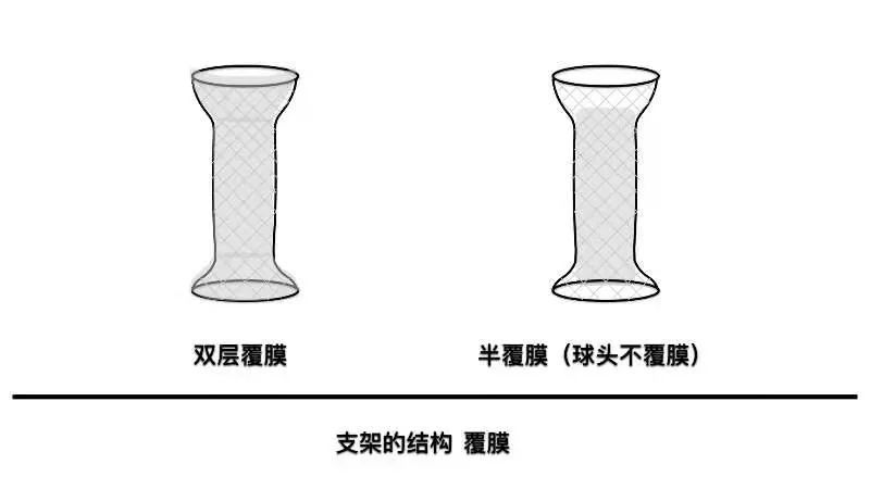 肠道|胃肠道支架-你的认识有多少？