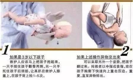 哈姆立克|当发生异物噎塞时，这样做能立马救人