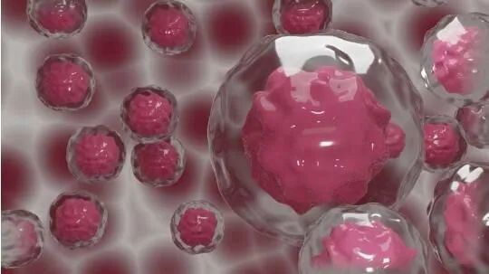 癌细胞|Cell Metabol：重磅！科学家发现有望攻击癌细胞的新型通路