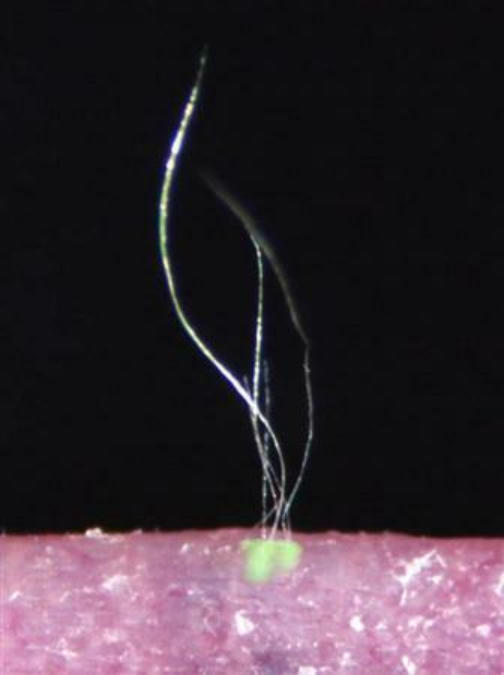 脱发|脱发患者的希望？日本成功研发老鼠体毛周期再生技术