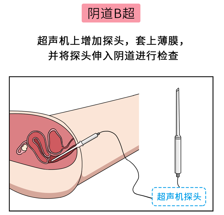 "羞羞"的妇科检查,到底查什么?(男生禁入)