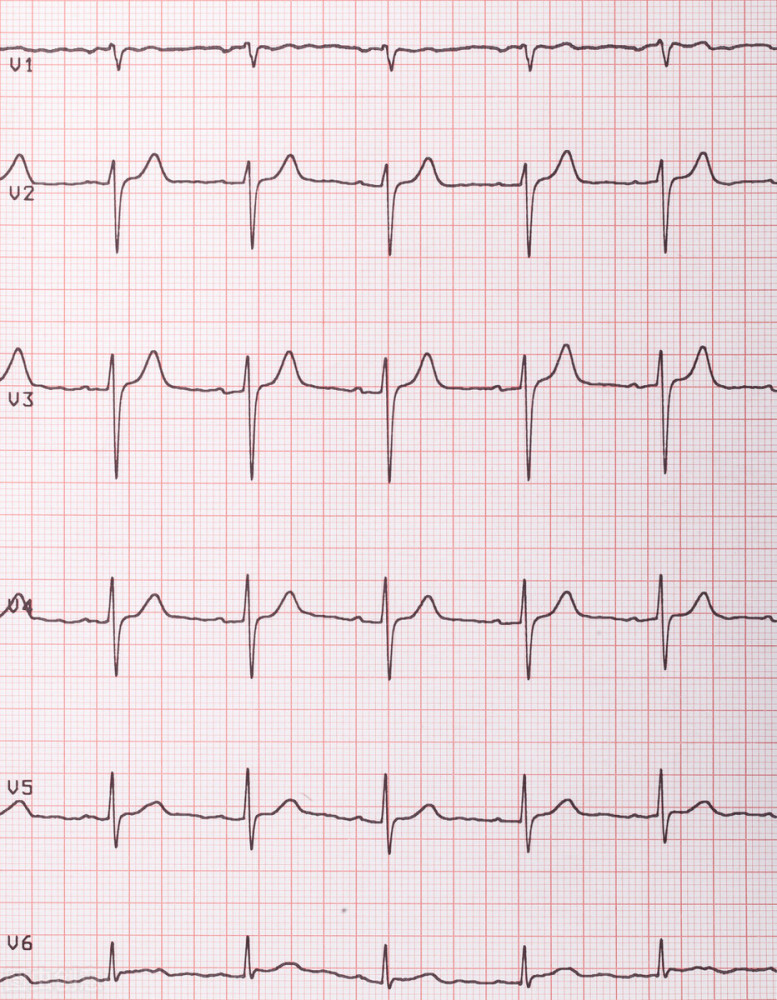 心电图|您了解心电图吗？知道心电图的意义有哪些吗？请看此文