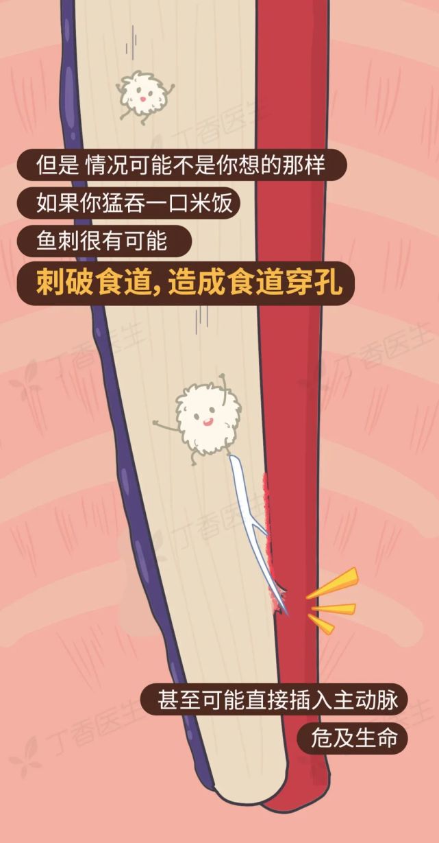 内脏器官最终导致死亡鱼刺不能强行吞当鱼刺卡住喉咙时尝试用镊子取出