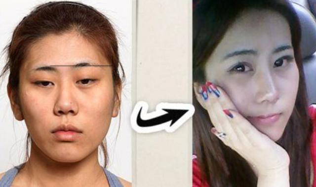 整容高达200次公开质疑李小璐博眼球为了变美断骨成残疾