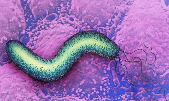 幽门螺旋杆菌如何伤害胃部胃黏膜其胃溃疡后果你预料得到吗