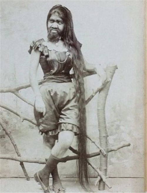 1881年,挪威猎人在原始森林抓到的野人女孩怎样了?结局令人痛心