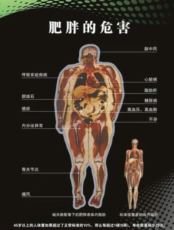 基因|饭量与寿命有关吗？研究发现，寿命还与30％的基因存在关系