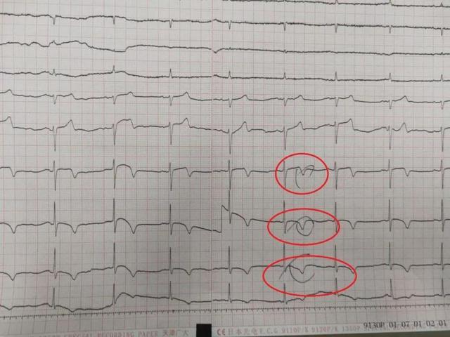 急诊|从拒绝签字到死亡仅1个小时！急诊医生：现在想起来都后怕