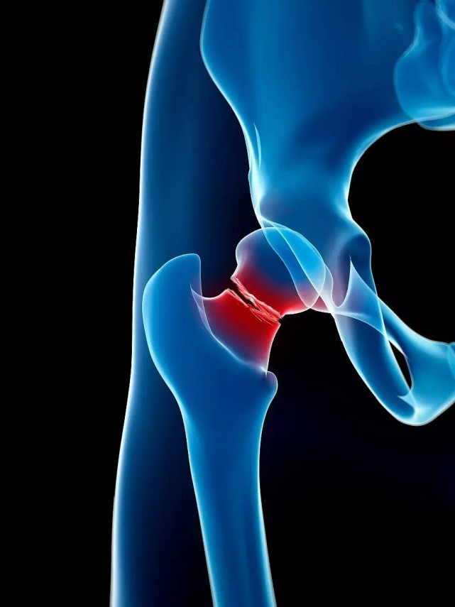 出现跌打损伤会导致骨折吗?对于常见摔倒撞伤应该如何处理?