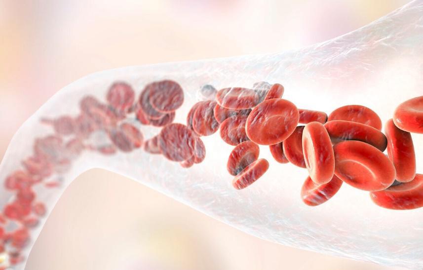 动脉硬化|动脉硬化作为一种心血管疾病，为何近年来高发？平常请少做2件事