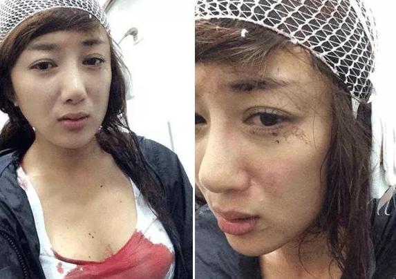 出道鲜少绯闻,被称古装第一美女,却被狗咬毁容,今整容5次大变