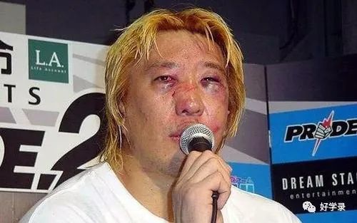 世界上最抗揍的人你知道吗