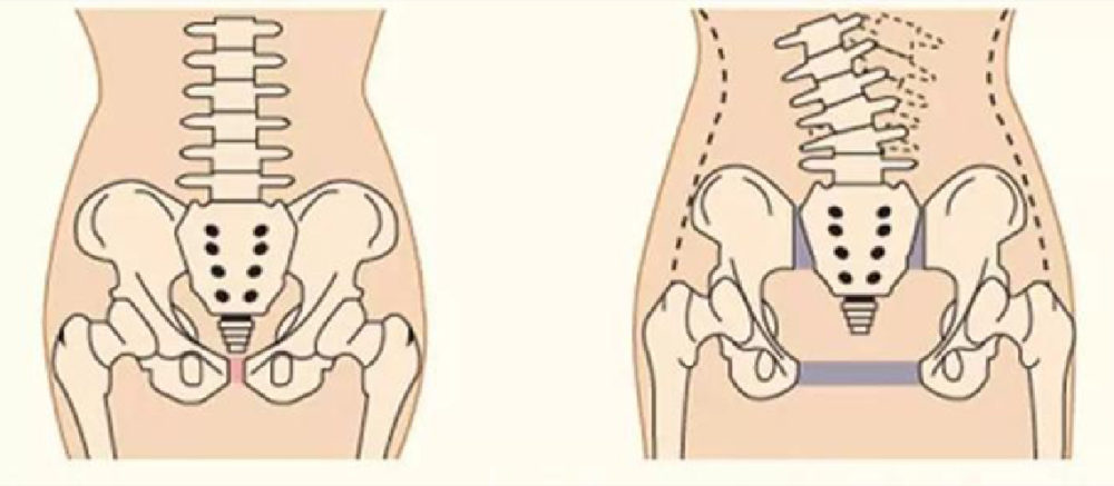 让准妈妈们的宫口从正常的大小开到"十指"那么大才能顺利分娩