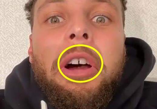 库里晒妻子巅峰颜值妩媚睡衣装秀恩爱萌神大牙缝却格外辣眼