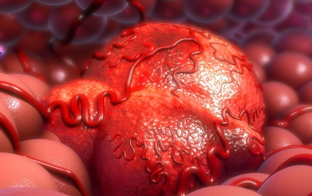 子宫颈|宫颈好不好？上厕所时出现2个“暗示”，HPV早就“找”上门了