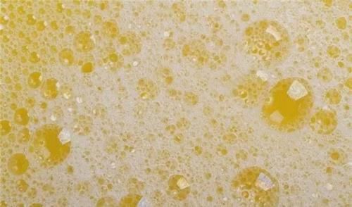 尿液泡沫多是糖尿病的征兆吗?尿液气味很重是什么疾病?