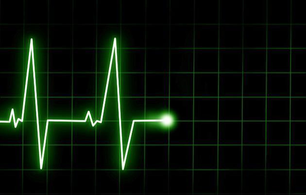 自己死亡自己知道科学家心脏停止跳动后你的意识会持续