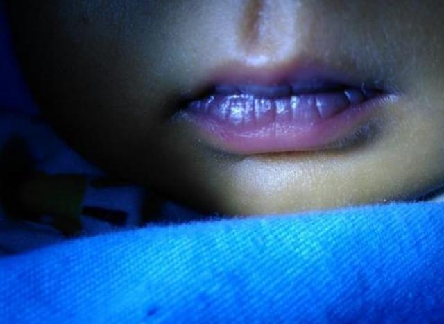 血液黏稠|血液粘稠的人，脸上会有4个信号发出，若一个没有，血液还算畅通