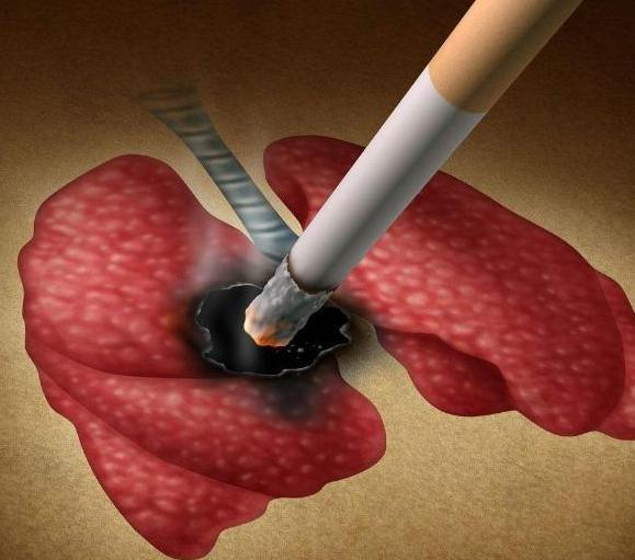 血液黏稠|血液粘稠的人，脸上会有4个信号发出，若一个没有，血液还算畅通