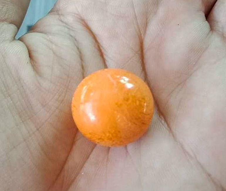 男子花11元买海螺吃出一颗罕见珍珠,要卖225万:想过好生活