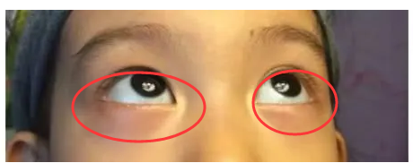 儿科医生:孩子挑食厌食不发育,或是积食脾虚了,家长要注意