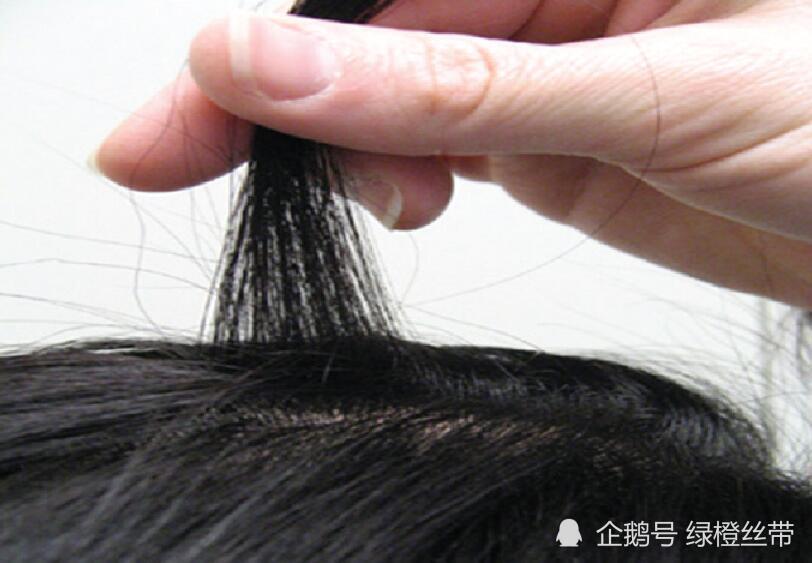 毛发|毛发检测吸毒几个月时间 准确性如何