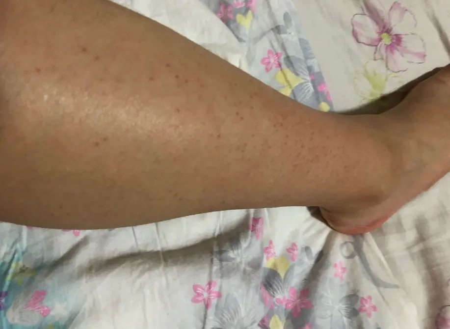 包含去鸡皮肤穿裙子的鞋子收纳的词条