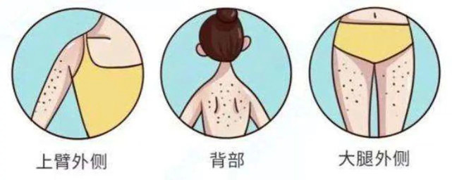 鸡皮肤要多喝水吗(鸡皮肤多喝水有用吗)