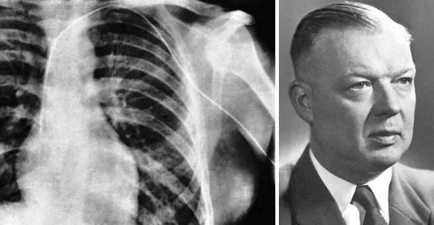 路易吉·伽伐尼|一百年前的人用什么奇葩设备测心电？他们用这些奇怪方式追寻真相