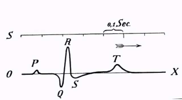 路易吉·伽伐尼|一百年前的人用什么奇葩设备测心电？他们用这些奇怪方式追寻真相