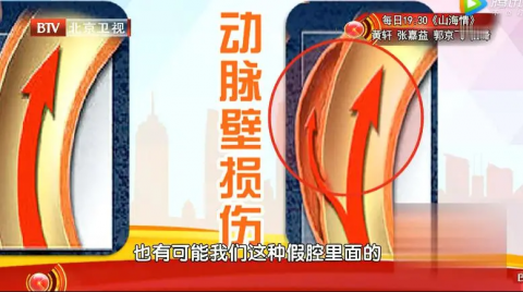 血管|一次按摩竟引发急性脑梗？血管有问题的人，这个部位千万别随便按！