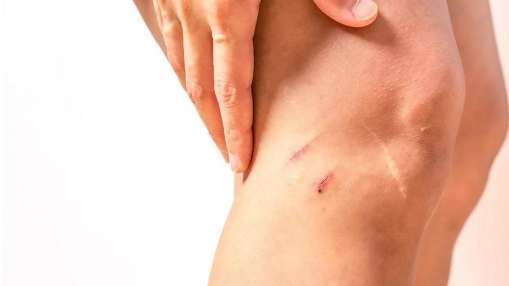 科学家|人类依然在进化，科学家发现人类正多了块骨头，但这却不是好事情