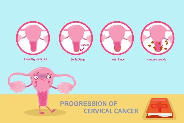 hpv|接种 HPV 疫苗之前，需要做检查吗？