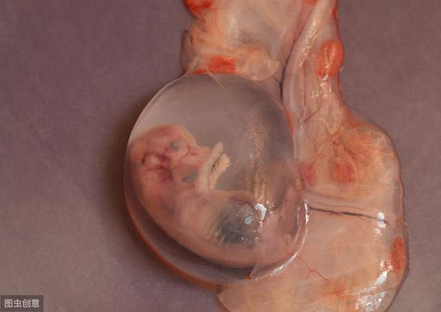 三个月胚胎流出来图片图片