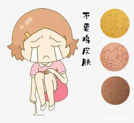 代谢不好鸡皮肤会痒吗(内分泌失调会引起鸡皮肤吗)