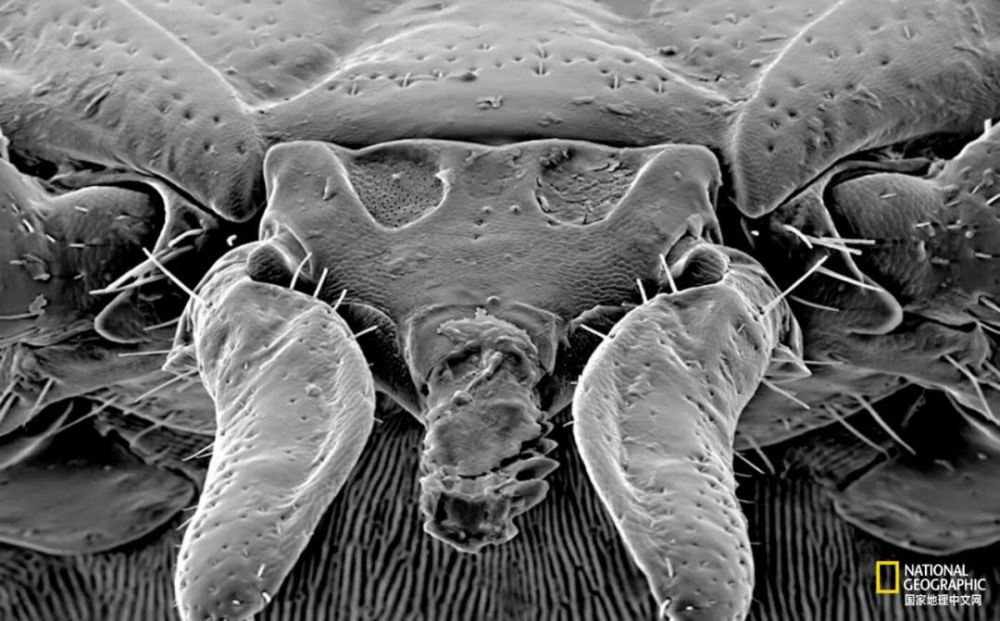 蜱虫|被这种虫子咬一口，这辈子就甭想吃肉了