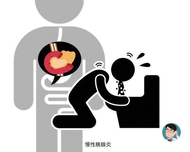 胰腺癌|胰腺癌为何被称为“癌王”？出现这3种现象，劝你务必及时就医