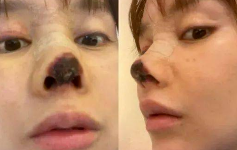 杨颖接受惩罚落入水中,抬头时鼻子却突然"变形",救场都晚了_腾讯新闻