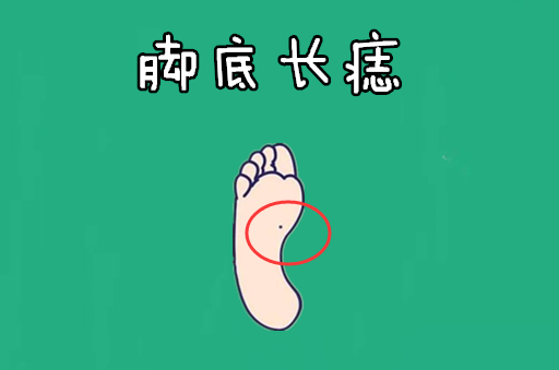 脚底长痣在相学当中,若是一个的脚底的位置处长有吉痣,则往往会被称之