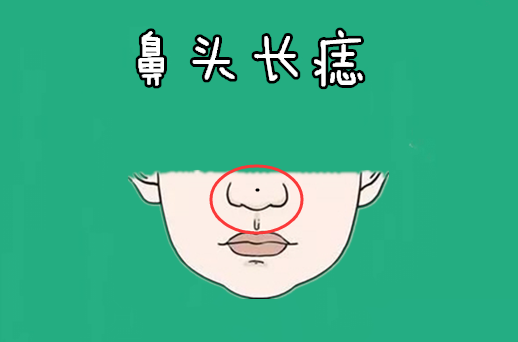 鼻头长痣鼻子主财,在相学当中具有非常重要的地位,代表的是他们的财运