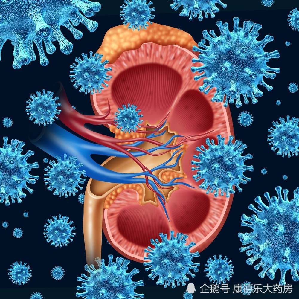 尿路结石|尿路结石很可怕！五大预防方法赶紧学起来！
