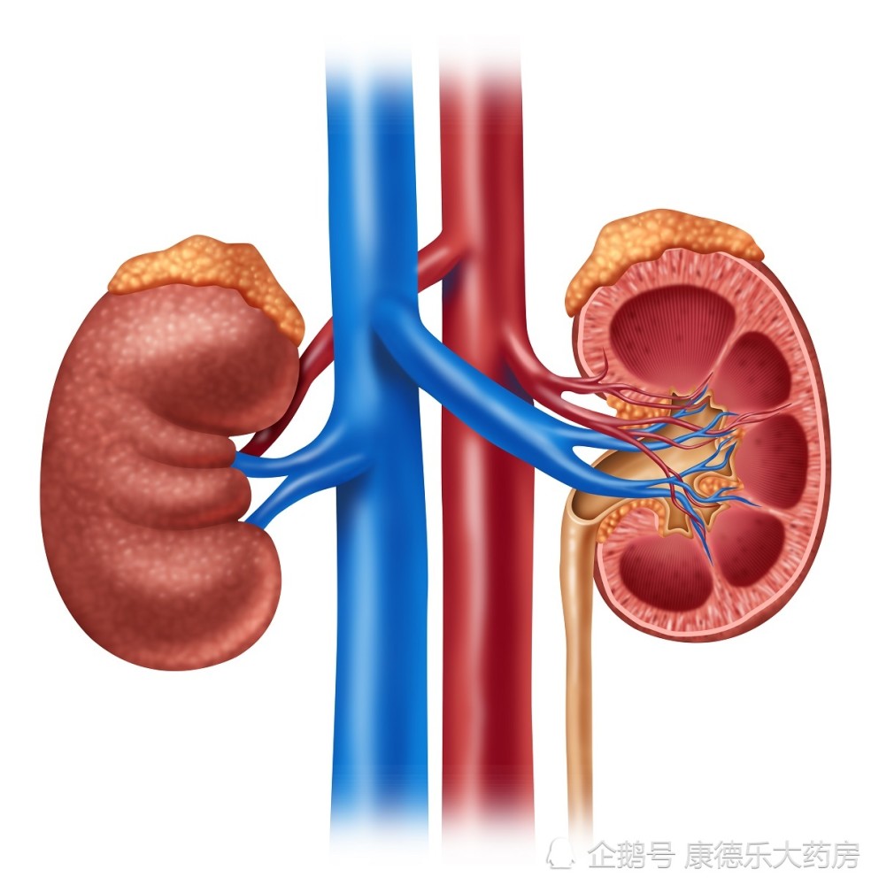 尿路结石|尿路结石很可怕！五大预防方法赶紧学起来！